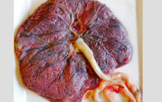 HelenZee.com placenta-320x202  